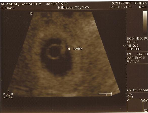 6 weeks 3 days -- 5-31-0602